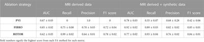 Exploring interpretability in deep learning prediction of successful ablation therapy for atrial fibrillation